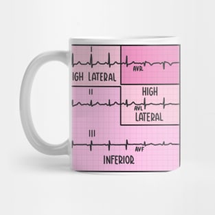 Hand Drawn Electrocardiogram (ECG) Pink Mug